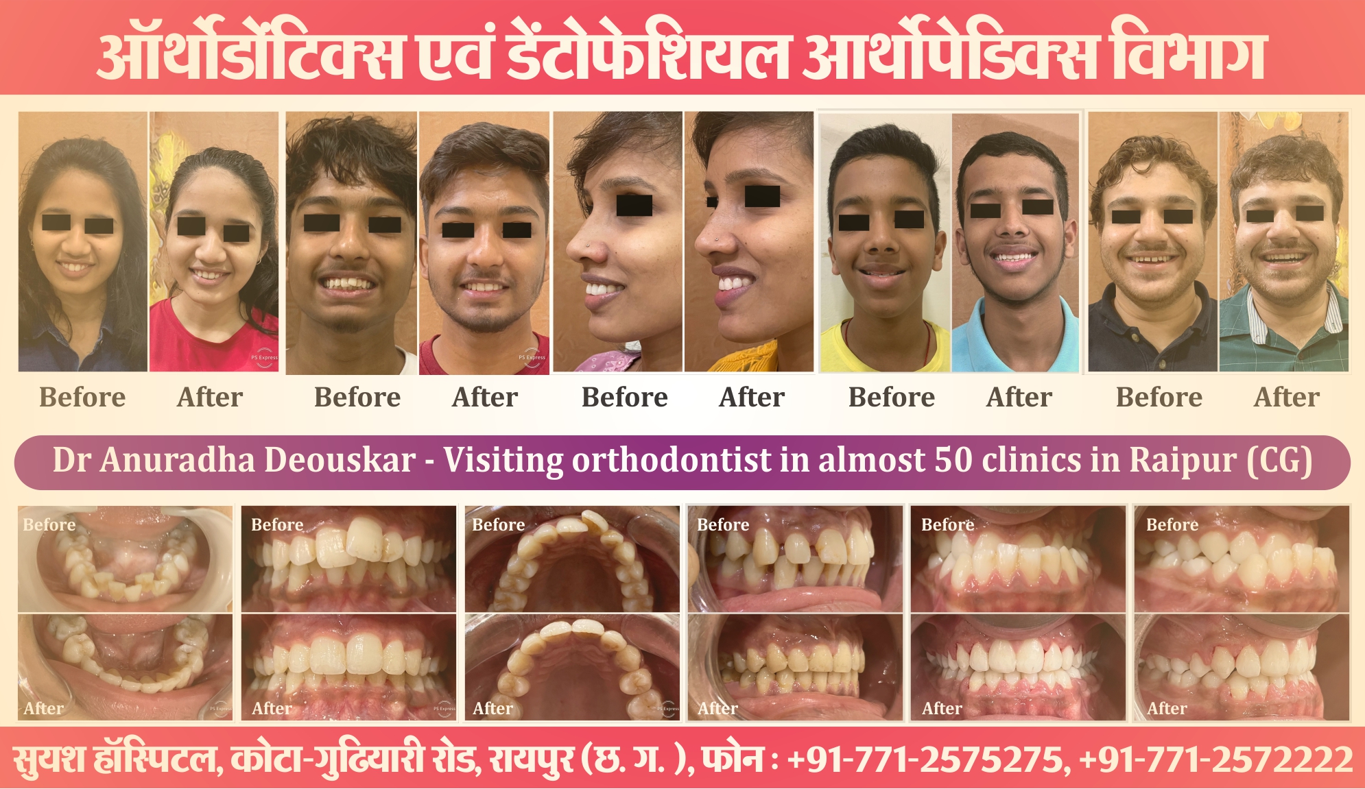 suyash orthodontics surgery 01