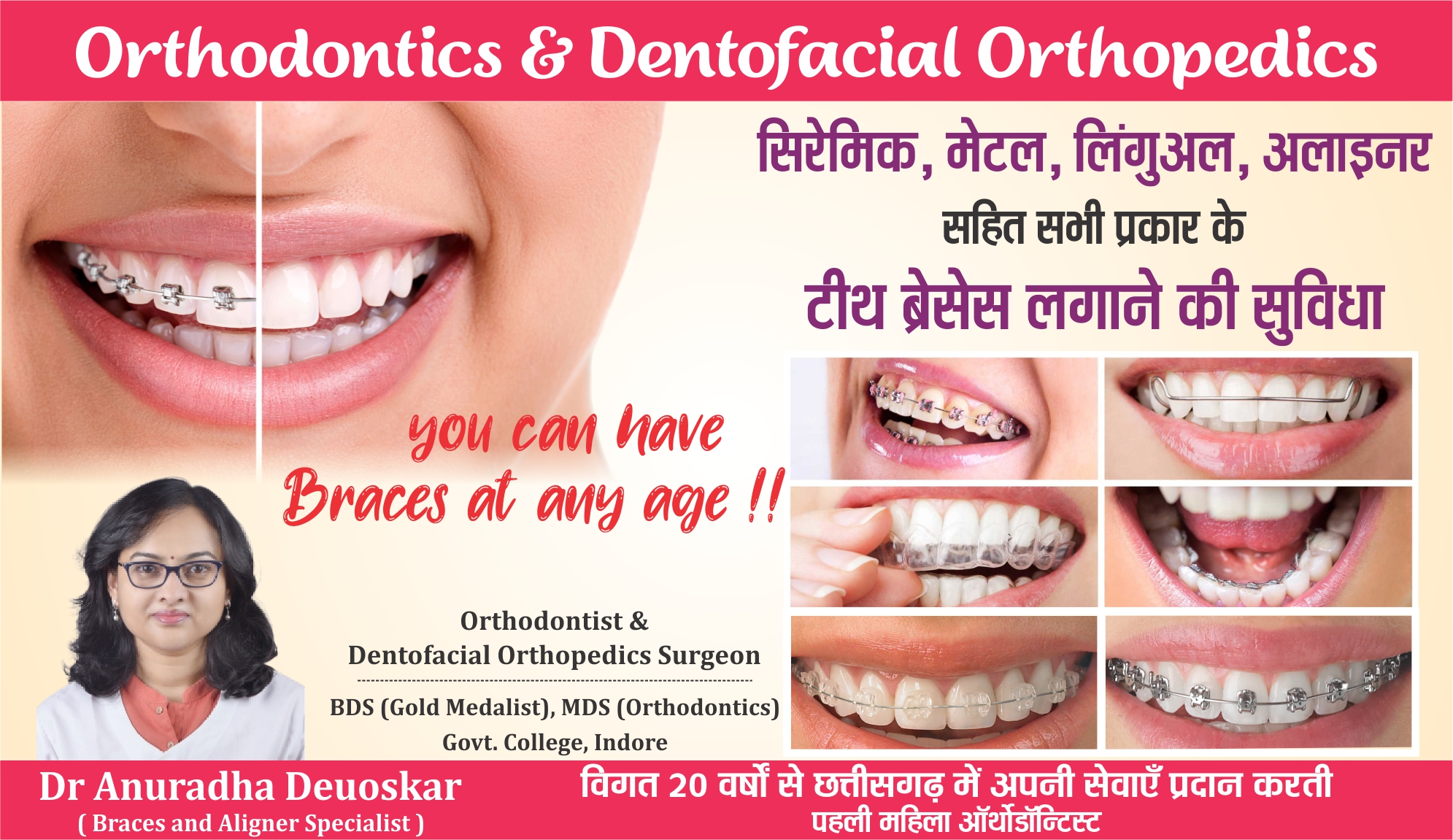 suyash orthodontics surgery 02